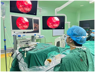 耳鼻喉内镜是什么科援藏专家助力开展耳内镜微创手术_https://www.jmylbn.com_新闻资讯_第3张