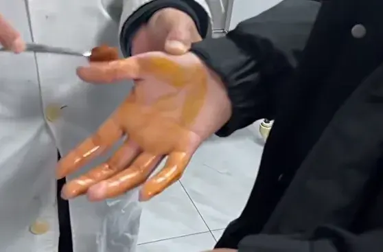 急救毯是什么材料这种毯子能救命，但别直接用手碰-上海聚慕医疗器械有限公司